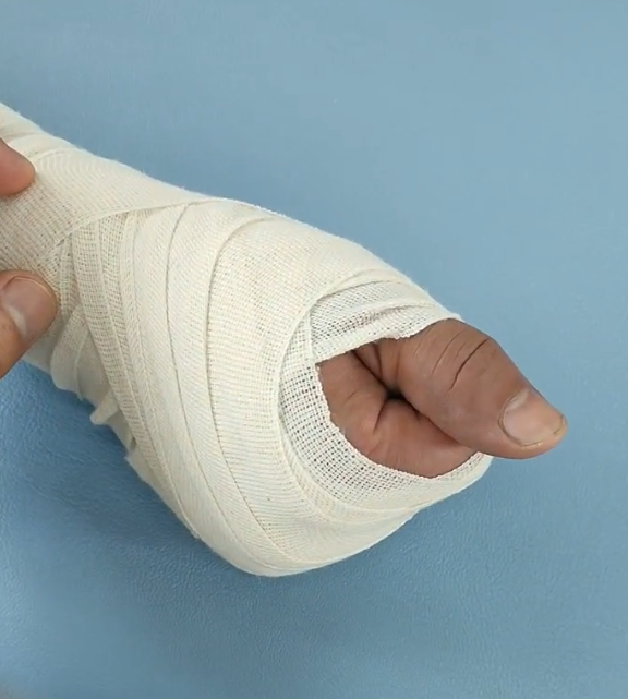 浙江湖州汇泉康复医院手外伤术后康复 - 浙江湖州汇泉康复医院